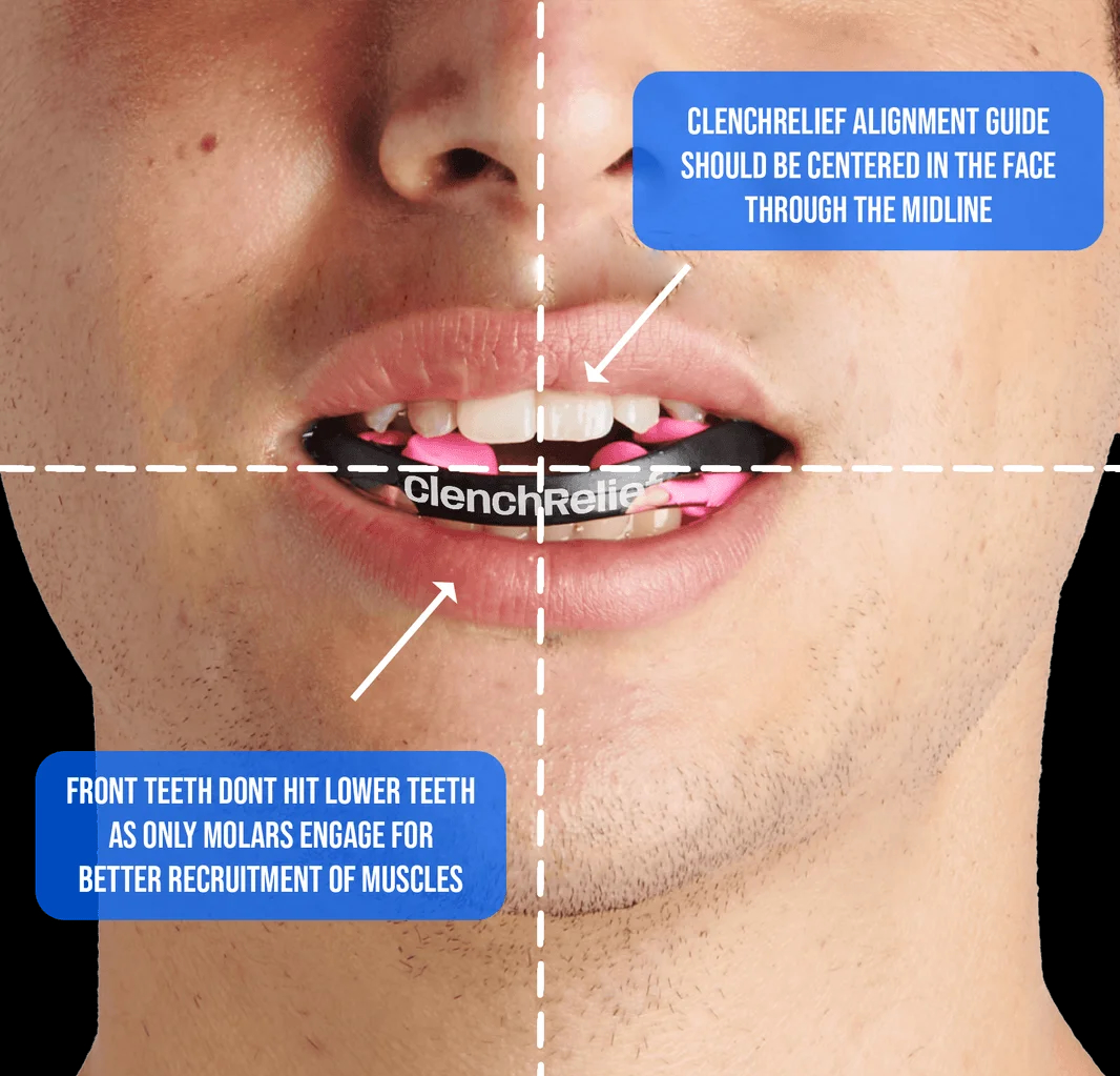 image of the Clench Relief™ Pro Rx Mouthpiece in the mouth with cross-hairs showing the accurate alignment vertically and horizontally