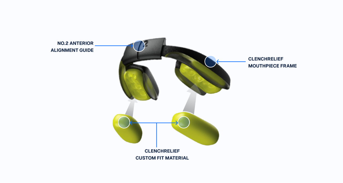 ClenchRelief mouthpiece with anterior alignment guide attached, and extra fit material illustrated.